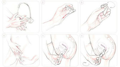 Como usar las copas menstruales